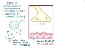 Myasthenia gravis (mg) is the most common neuromuscular junction disease and presents with weakness worsened by exertion but improving with rest. ÙˆÙ‡Ù† Ø¹Ø¶Ù„ÙŠ ÙˆØ¨ÙŠÙ„ ÙˆÙŠÙƒÙŠØ¨ÙŠØ¯ÙŠØ§
