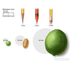 tumor size in millimeters image details nci visuals online