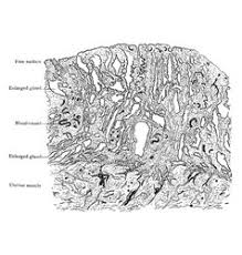 Uterus Draw Vector Images Over 480 Medical location and meaning diagram. vectorstock