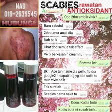 Anda boleh jadikan daun rosemary kering sebagai mandian, dijadikan sebagai bahan utama dalam mencuci cadar atau apa sahaja kain, sebagai ubat sapu untuk disapukan pada kudis buta dan dijadikan sebagai minuman teh kosong. Penawar Kudis Buta Paling Mujarab Kesihatan Dan Kecantikan