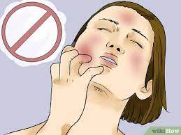 How To Prevent Skin Peeling After Sunburn: 15 Steps