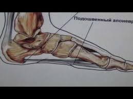 боль в пятке при ходьбе как лечить в домашних условиях Pyatochnaya Shpora Lechenie Pyatochnoj Shpory Narodnymi Sredstvami V Domashnih Usloviyah Youtube S Izobrazheniyami Pyatochnaya Shpora Alternativnaya Medicina Bol V Pyatke