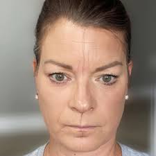 My friend's face is not symmetrical.The right side is much thicker than the  left.Left side seems thinner.Any SW/no/SP for this?