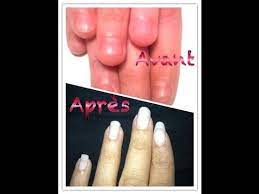 Astuce Ne Plus Se Ronger Les Ongles Tip No Nail Biting Youtube