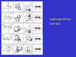Sie wurde von john m. Benigner Paroxysmaler Lagerungsschwindel Ppt Video Online Herunterladen