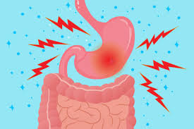 Acid secretion is stimulated by nerve impulses to the stomach, gastrin (a hormone released. The Link Between Inflammatory Arthritis And Gastrointestinal Problems