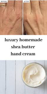 Hand Cream Luxury Homemade Shea Butter Cream Best Wellness Guide In 2020 Shea Butter Hand Cream Hand Cream Homemade Shea Butter Cream