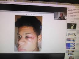 We Have to Stand for Justice' Leader Says in Wake of Police Brutality  Claims