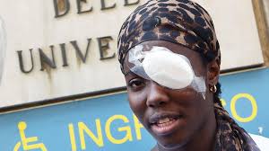 His academic interest is in monetary economics. Italian Athlete Osakue Fears Climate Of Violence After Attack Bbc News