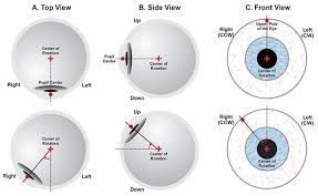 Image result for Extraocular Movement