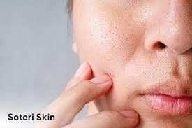 Image result for Dry Skin