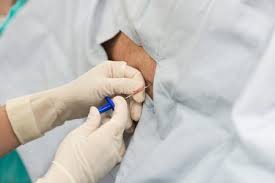 Dolor De Cabeza Tras Una Infiltracion Epidural Espaldaycuello Com