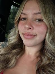 hope u like freckle faces n braces :)