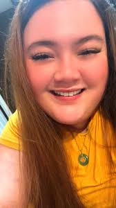 Amputee's Journey of Self-Acceptance and Inspiration