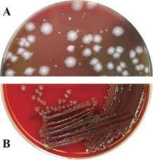 First Report Of Anaerobic Isolation Of Salmonella Enterica From Liver Abscesses Of Feedlot Cattle Journal Of Clinical Microbiology