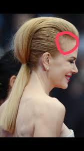 Die medizinische bezeichnung dafür ist calvities frontalis. Yskgjt Com Geheimratsecken Frisur Tipps Frauen Frisur Geheimratsecken Frisuren Lange Haare Geflochten Schnell Lange Haare