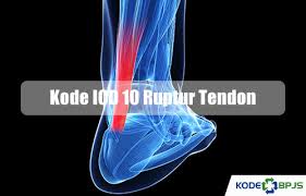 The following codes indicate ulcer of the lower limb or foot Kode Icd 10 Ruptur Tendon 2021 Gejala Diagnosis Kodebpjs