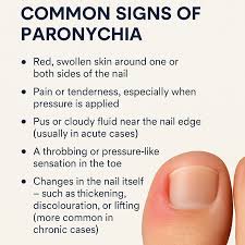 Image result for Paronychia feet