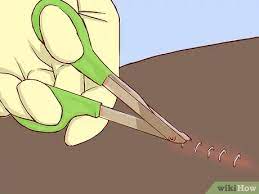 Chirurgische Klammern Entfernen 8 Schritte Mit Bildern Wikihow