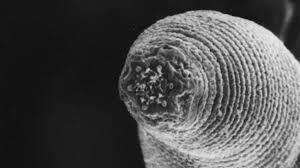 Jan 14, 2021 · parasiten haben folgende eigenschaften, die dem darm schaden: Parasiten Diese Schmarotzer Nisten Sich Heimlich Im Menschen Ein