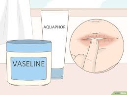 Take Care Of Your Skin While On Accutane Accutane Take Care Of Yourself Skin Dryness