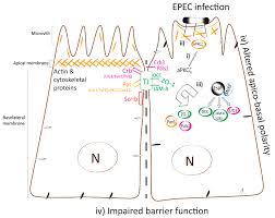 Coli pathotypes, are among the most important pathogens infecting children worldwide because of their high prevalence in both the. Ijms Free Full Text Enteropathogenic Escherichia Coli Epec Recruitment Of Par Polarity Protein Atypical Pkcz To Pedestals And Cell Cell Contacts Precedes Disruption Of Tight Junctions In Intestinal Epithelial Cells