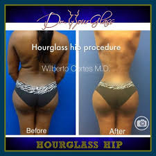 Pin On Before And After