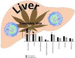 Reduced Incidence And Better Liver Disease Outcomes Among Chronic Hcv Infected Patients Who Consume Cannabis