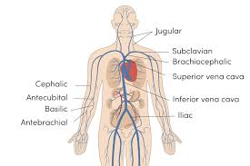 Image result for IV Access