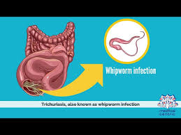Image result for Whipworm