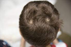 I 39 M A Male And I Have Weird Hair So I Don 39 T Know How To Style It Crazy Hair Cowlick Hair