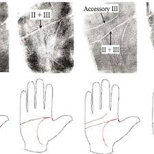 Check spelling or type a new query. Simian Crease Prevalence Rate Of Diverse Human Populations Download Scientific Diagram