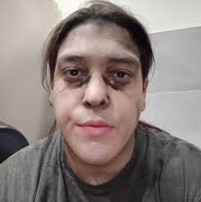 Haha microplastics go brrr