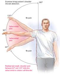 Image result for Shoulder Exam
