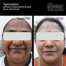 Skin Specialist in Mumbai