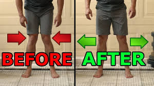 Fortunately, your talkative knees are usually not a cause for concern. 5 Ways To Fix Knocked Knees Tight Inner Thighs Youtube