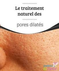 Traitement Naturel Les Pores Dilates Eliminez Les Une Bonne Fois Pour Toutes Acne Traitement Naturel Acne Traitement Pores Dilates