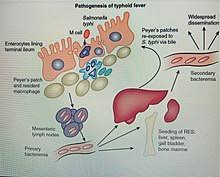 We did not find results for: Typhoid Fever Wikipedia