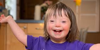 When the person's genes have an extra copy of chromosomes, it is known as chromosomes 21. Down Syndrome Stories 21 Things Parents Wish They Knew