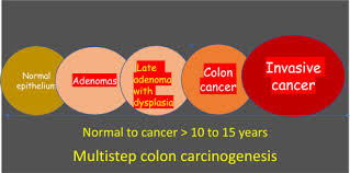 Get the facts on colon cancer (colorectal cancer) signs, symptoms, causes, prognosis, treatment information, and prevention screening through colonoscopy. Epidemiology Of Colorectal Cancer Sciencedirect