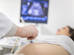 It's a way of checking your baby's risk of certain birth defects, such as down syndrome, edward's syndrome (trisomy. Nuchal Translucency Nt Scan Babycenter India