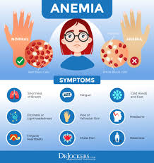 Anemia: Causes, Symptoms and Support Strategies - DrJockers.com