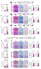 Invisibility is definitely not among this show's problems. Cancers Free Full Text The Atf6 Egf Pathway Mediates The Awakening Of Slow Cycling Chemoresistant Cells And Tumor Recurrence By Stimulating Tumor Angiogenesis Html
