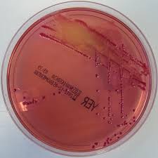 Image result for yersinia fotos