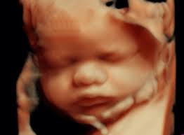 Clínica de Santos é a 1ª da região com ultrassom 3D/4D Live