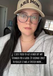 Stretch Mark Hair Feather