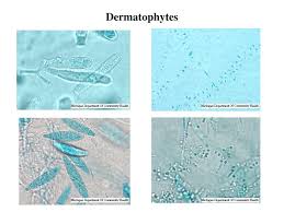 mycology survey id of normal dermatophytes