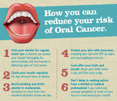 Gum cancer is an oral cancer. Could You Recognize Signs And Symptoms Of Oral Cancer In Your Mouth