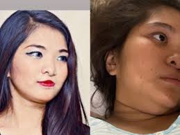 Fundraiser by JENNIFER MANIBUSAN : Operation BLAISE