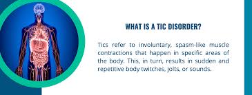 Image result for Tic Management